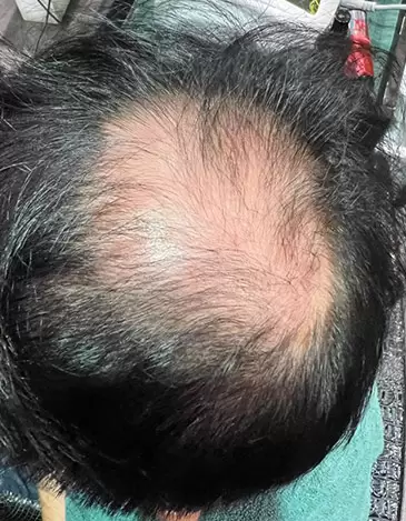 Before image