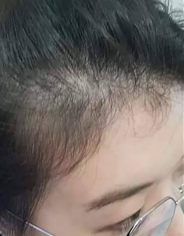 Before image